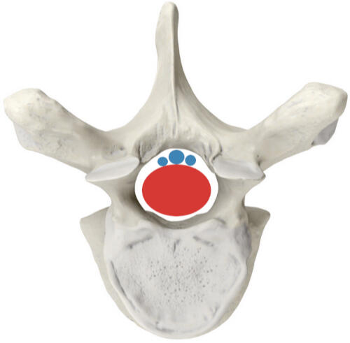 Marked Vertebra